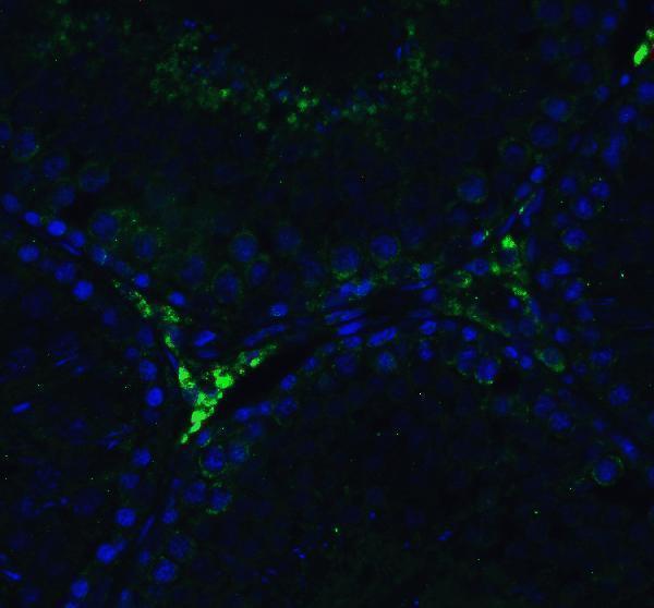 a00244 ddx58 primary antibodies if testing 5