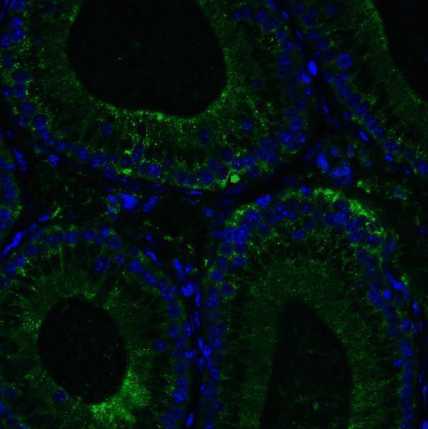 a00244 ddx58 primary antibodies if testing 6