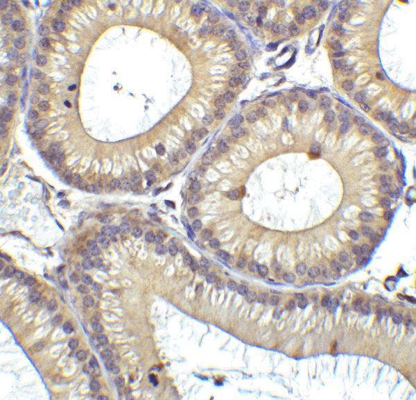 a00244 ddx58 primary antibodies ihc testing 2