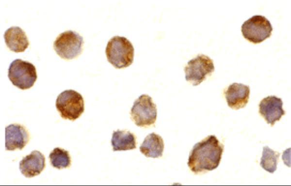 a00245 btk primary antibodies icc testing 4
