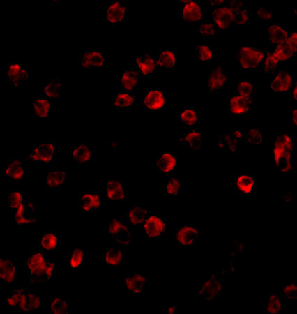 Immunofluorescence of BTK in Daudi cells with BTK antibody at 10 μg/mL