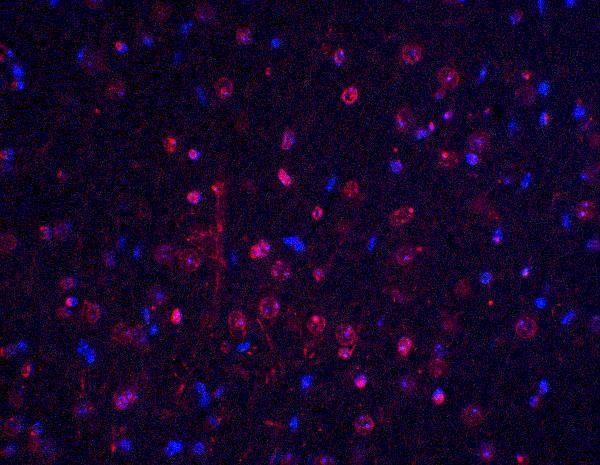 a00245 btk primary antibodies if testing 5