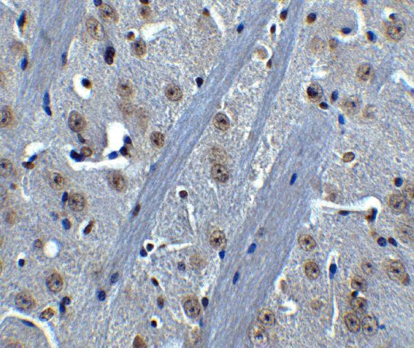 Immunohistochemistry of BTK in mouse brain tissue with BTK antibody at 5 μg/mL