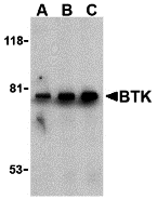 Western blot analysis of BTK in U937 cell lysate with BTK antibody at (A) 0