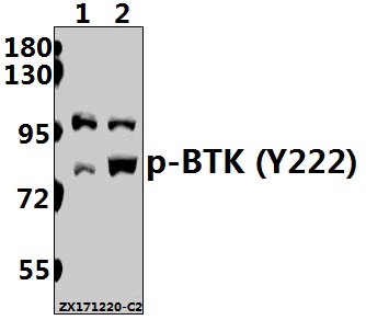 Western blot (WB) analysis of p-BTK (Y222) pAb at 1:500 dilution
Lane1:Jurkat whole cell lysate(40ug)
Lane2:K562 whole cell lysate(40ug)