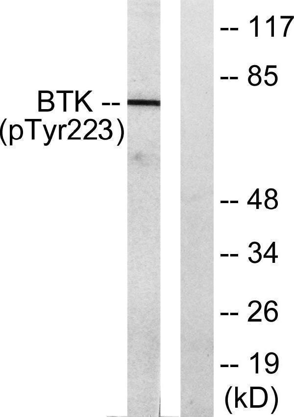 a00245y223 btk primary antibodies wb testing 3