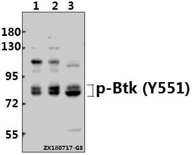 Western blot (WB) analysis of p-Btk (Y551) pAb at 1:500 dilution
Lane1:K562 whole cell lysate(40ug)
Lane2:Myla2059 whole cell lysate(40ug)
Lane3:U-87MG whole cell lysate(40ug)
