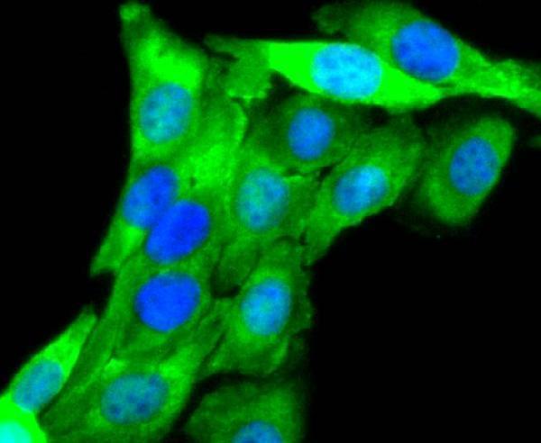 ICC staining Aurora A in SKOV-3 cells (green)
