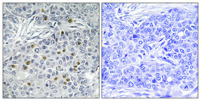 Immunohistochemistry validation of AURKA using Anti-ARK-1 AURKA Antibody (A00246-2)