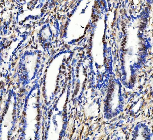  IHC analysis of Aurora A/AURKA using anti-Aurora A/AURKA antibody (A00246-4)