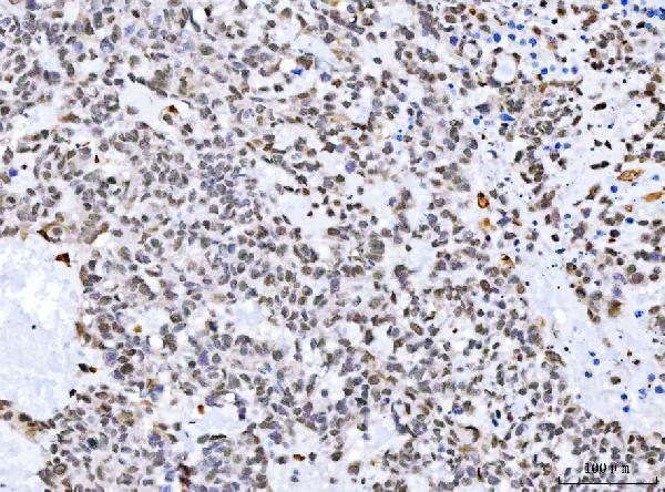  IHC analysis of Aurora A/AURKA using anti-Aurora A/AURKA antibody (A00246-4)