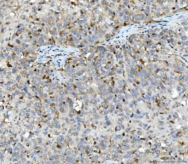 a00246 4 aurka primary antibodies ihc testing 5