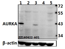 Western blot (WB) analysis of AURKA (P282) polyclonal antibody at 1:500 dilution
Lane1:Hela whole cell lysate(40ug)
Lane2:HepG2 whole cell lysate(40ug)
Lane3:L02 whole cell lysate(40ug)
Lane4:C6 whole cell lysate(40ug)
Lane5:BV2 whole cell lysate(40ug)