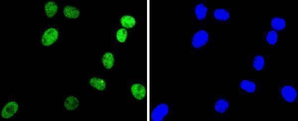 a00247 1 arid1a primary antiboties icc testing 1