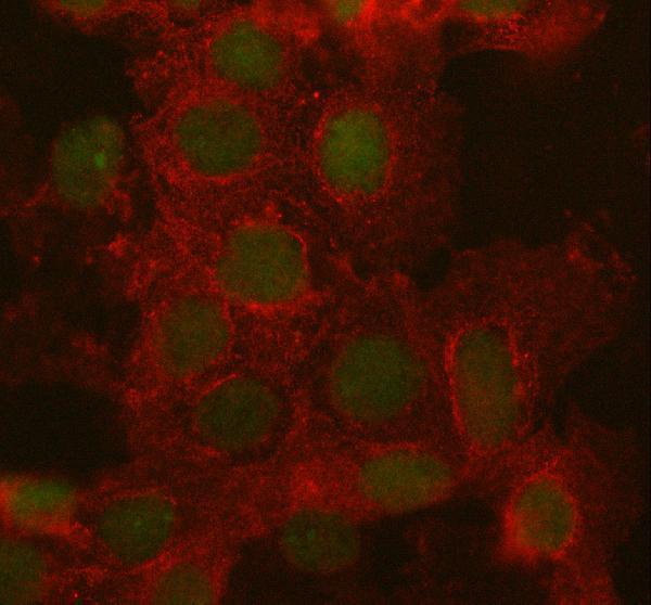 a00247 2 arid1a primary antibodies if testing 6