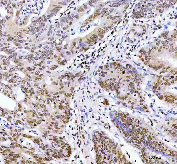  IHC analysis of ARID1A using anti-ARID1A antibody (A00247-2)