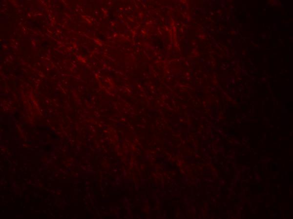 a00247 arid1a primary antibodies if testing 3