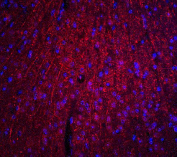 a00247 arid1a primary antibodies if testing 4