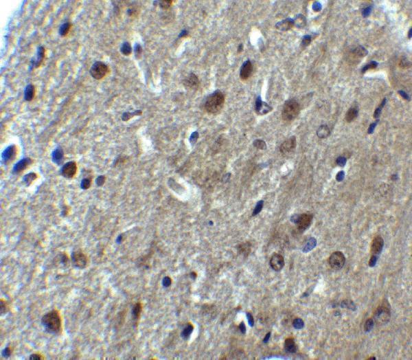 a00247 arid1a primary antibodies ihc testing 2