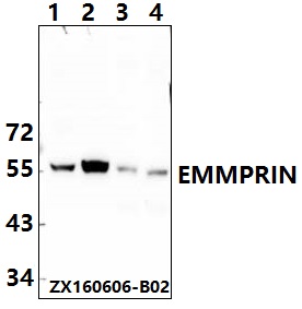 Western blot (WB) analysis of EMMPRIN (Q370) polyclonal antibody at 1:500 dillution
Lane1:HEK293T whole cell lysate
Lane2:DLD whole cell lysate
Lane3:The fetal heart tissue lysate of Mouse
Lane4:The fetal heart tissue lysate of Rat