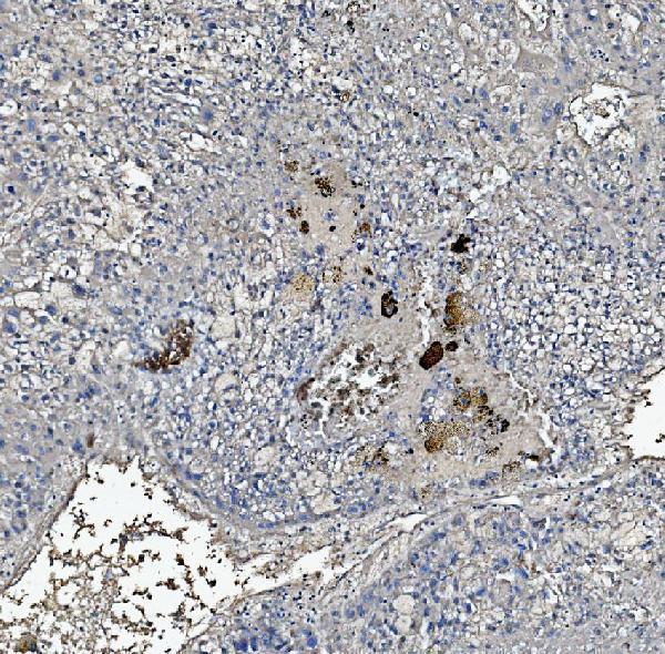 a00249 4 crp primary antibodies ihc testing 2