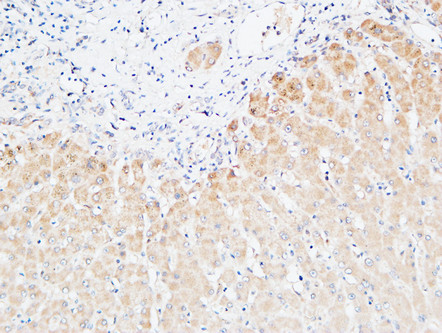 Immunohistochemical analysis of paraffin-embedded Human Liver