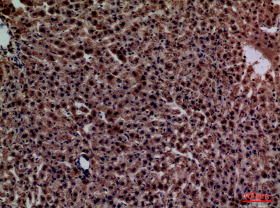 a00249 crp primary antibodies ihc testing 4