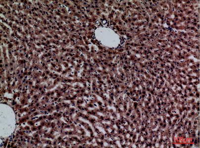 a00249 crp primary antibodies ihc testing 5