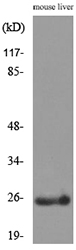 Western blot analysis of lysate from mouse liver cells, using CRP Antibody