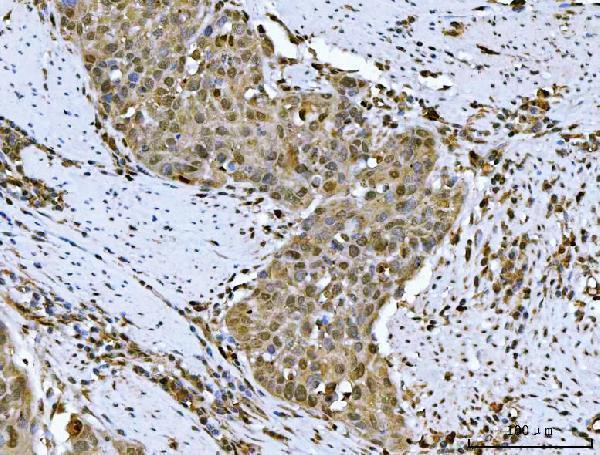  IHC analysis of HSF1 using anti-HSF1 antibody (A00250)