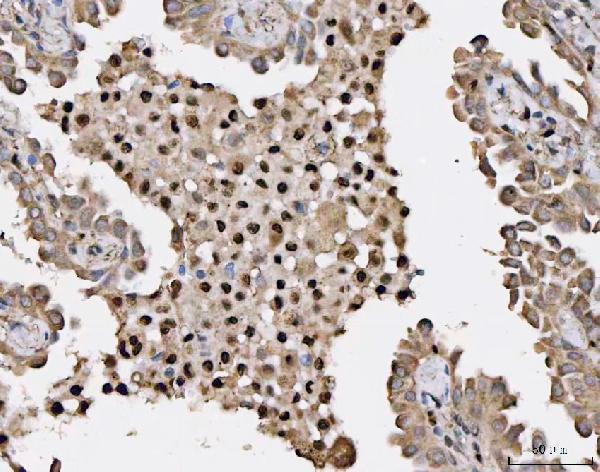  IHC analysis of HSF1 using anti-HSF1 antibody (A00250)