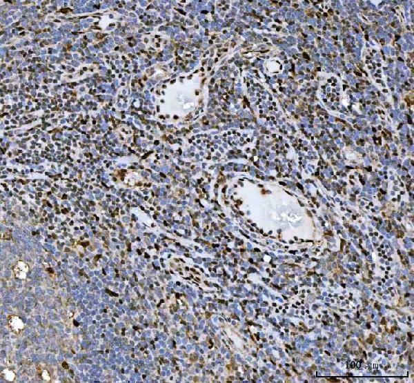 a00250 hsf1 primary antibodies ihc testing 5