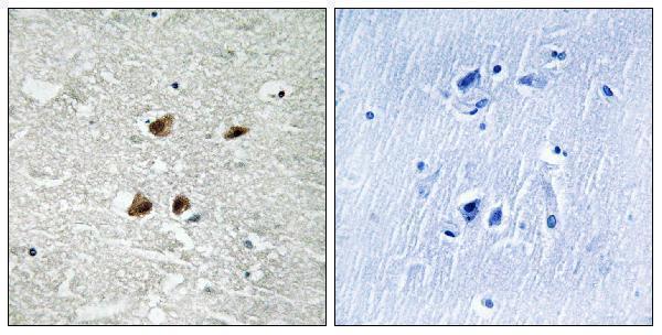 a00250s121 hsf1 primary antibodies ihc testing 1