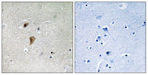 a00250t142 hsf1 primary antibodies ihc testing 2