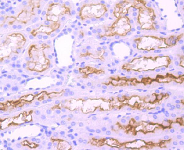 a00251 1 ace primary antiboties ihc testing 2
