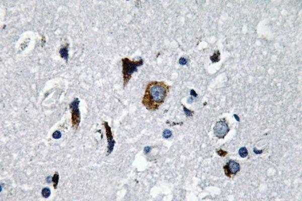a00251 2 ace primary antibodies ihc testing 1