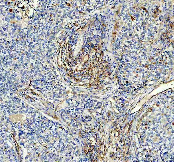 a00251 3 ace primary antibodies ihc testing 2