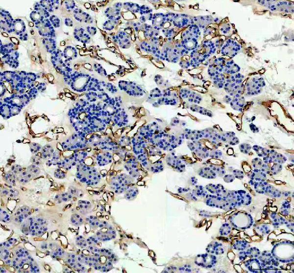 a00251 3 ace primary antibodies ihc testing 3