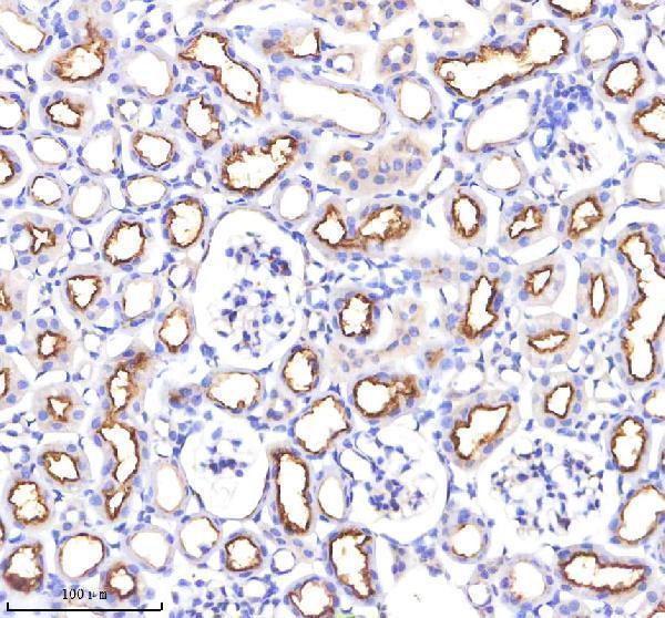 a00251 3 ace primary antibodies ihc testing 4