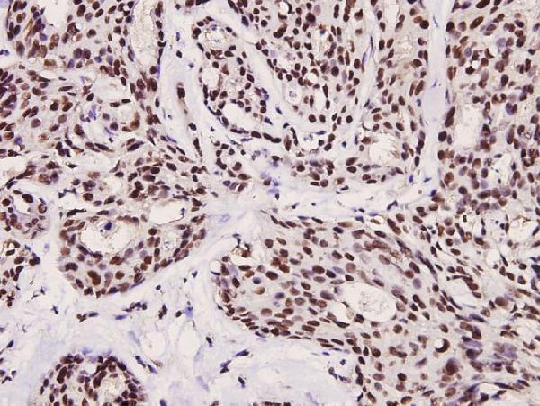 a00252s253 foxo3 primary antiboties ihc testing 2