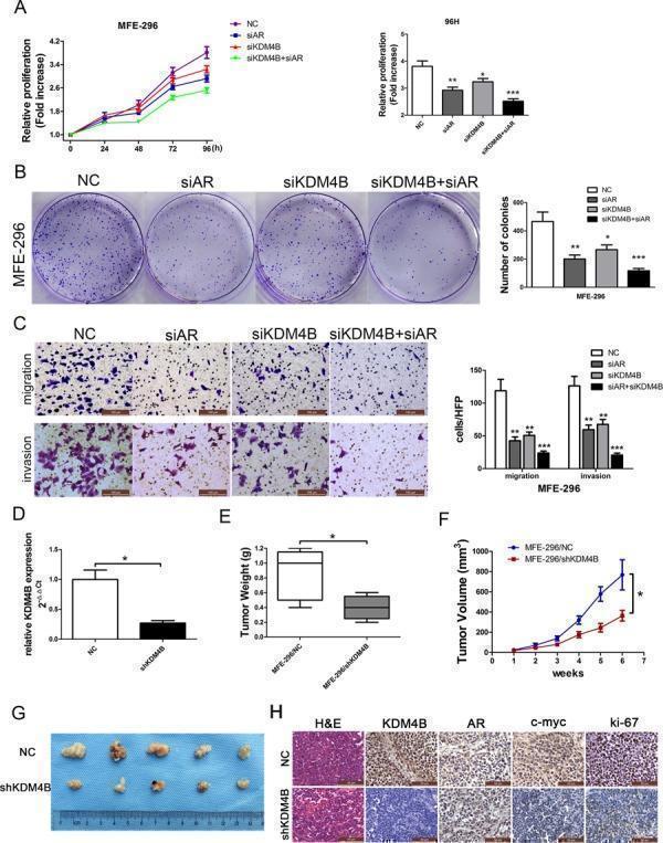 KDM4B promotes AR-mediated carcinogenesis in MFE-296 cells