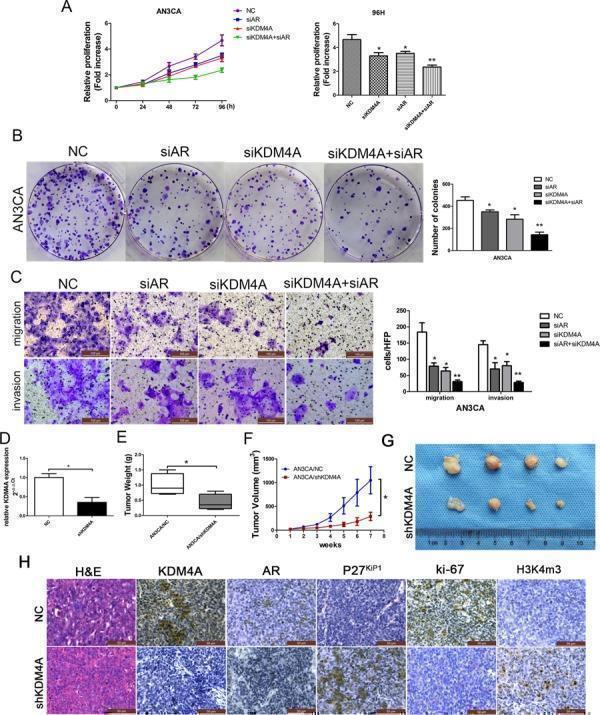 KDM4A, but not KDM4B, promotes AR-mediated carcinogenesis in AN3CA cells