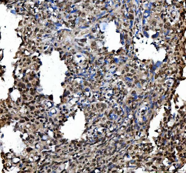 a00254 ki67 primary antibodies ihc testing 2_1