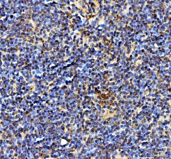 a00254 ki67 primary antibodies ihc testing 5_1