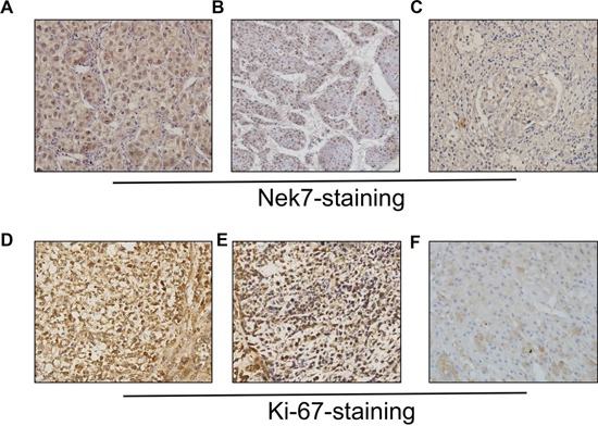 a00254 oncotarget 07 18620 g002
