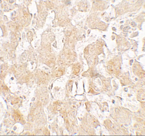 Immunohistochemistry of UCP1 in human liver tissue with UCP1 antibody at 2