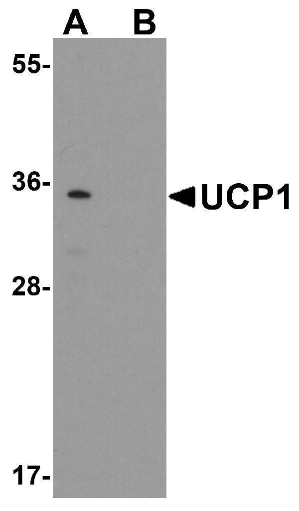 Western blot analysis of UCP1 in human brain tissue lysate with UCP1 antibody at 1 μg/mL in (A) the absence and (B) the presence of blocking peptide