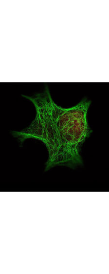 a00256 1 hdac1 primary antibodies if testing 4