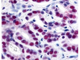 Immunohistochemistry of Rabbit Anti-HDAC-1 Antibody