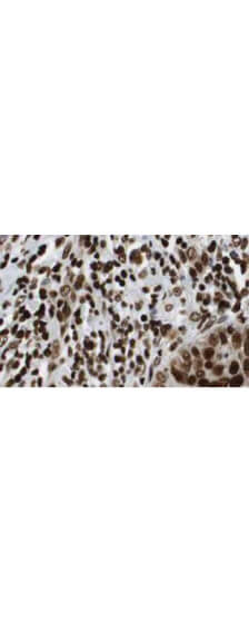 Immunohistochemistry of Rabbit Anti-HDAC-1 Antibody